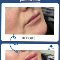 تخفیفات ویژه/اگزوزوم/مزو ژل/لیفتینگ/فشیال تخصصی|خدمات آرایشگری و زیبایی|شیراز, وحدت|دیوار