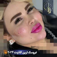 تزریق ژل وبوتاکس ومادلینگ اروپایی وهایفو درکلینیک|خدمات آرایشگری و زیبایی|کرمانشاه, |دیوار