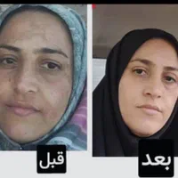 کرم ضدلک رویال