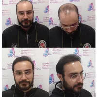 کلینیک تخصصی آوینا|خدمات آرایشگری و زیبایی|تهران, گاندی|دیوار