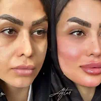 آموزش و انجام خدمات پوست و مو ژل و بوتاکس و..|خدمات آرایشگری و زیبایی|نور, |دیوار