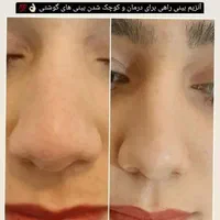 جشنواره ژل بوتاکس آنزیم فیلر پرسینگ فشیال پاکسازی|خدمات آرایشگری و زیبایی|مشهد, صیاد شیرازی|دیوار