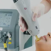 اپراتور لیزر دستگاه کندلا