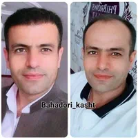 جشنواره کاشت مو