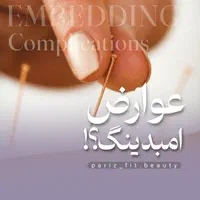 حجامت بادکش امبدینگ طب سوزنی فصد خون زگیل تناسلی|خدمات آرایشگری و زیبایی|اصفهان, سعادت‌آباد|دیوار