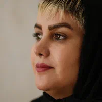 عمل بینی/جراحی بینی/اقساط بدون سود|خدمات آرایشگری و زیبایی|شیراز, فرهنگ شهر|دیوار