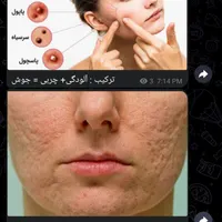 آموزش کامل مجازی فیشال ویژه خانم ها و آقایان|خدمات آموزشی|سراوان, |دیوار