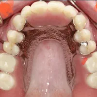 دندانسازی سینا ساخت دندان مصنوعی سازی متحرک و نرم|خدمات آرایشگری و زیبایی|شیراز, سینما سعدی|دیوار