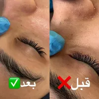 فیشال و خدمات تخصصی پوست توسط پیراپزشک در مطب پزشک|خدمات آرایشگری و زیبایی|مشهد, سجاد شهر|دیوار