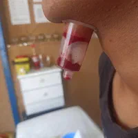 حجامت رفع مشکلات کبدی تیرگی پوست خستگی و غلظت خون|خدمات آرایشگری و زیبایی|ایلام, |دیوار