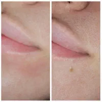 مرکز زیبایی دکتر تقوی|خدمات آرایشگری و زیبایی|یاسوج, |دیوار