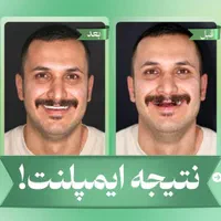 کلینیک تخصصی ایمپلنت دیجیتال5400/فوری/کاشت دندان|خدمات آرایشگری و زیبایی|تهران, پاسداران|دیوار