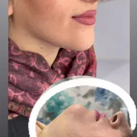 تزریق چربی فیلربادی تزریق ژل در مطب پزشک|خدمات آرایشگری و زیبایی|کرمانشاه, |دیوار