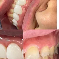 ارتودنسی توسط متخصص،دندانپزشکی اطفال،متخصص زیبایی|خدمات آرایشگری و زیبایی|اصفهان, هفتون|دیوار