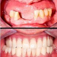 دندانپزشکی/ایمپلنت/اقساطی/زیبایی/کامپوزیت|خدمات آرایشگری و زیبایی|تبریز, |دیوار