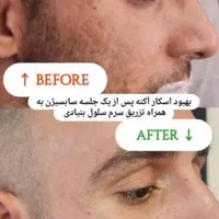 تخفیفات ویژه/اگزوزوم/مزو ژل/لیفتینگ/فشیال تخصصی|خدمات آرایشگری و زیبایی|شیراز, وحدت|دیوار