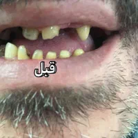 دندانپزشکی و دندان سازی خیریه چمران (جراحی. زیبایی|خدمات آرایشگری و زیبایی|تهران, امام حسین|دیوار