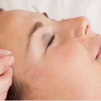حجامت بادکش امبدینگ طب سوزنی فصد خون زگیل تناسلی|خدمات آرایشگری و زیبایی|اصفهان, سعادت‌آباد|دیوار