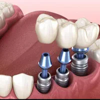 مرکز دندانپزشکی تخصصی|خدمات آرایشگری و زیبایی|اصفهان, عباس‌آباد|دیوار