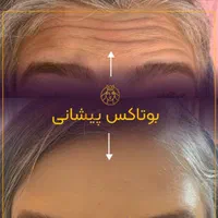 کلینیک تزریق ژل،رفع گودی زیر چشم،بوتاکس،لیزر،هایفو|خدمات آرایشگری و زیبایی|تهران, ستارخان|دیوار