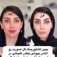 تزریق ژل بوتاکس لیفت نخ هایفو بلفاروپلاستی لیزر|خدمات آرایشگری و زیبایی|مشهد, کوه سنگی|دیوار