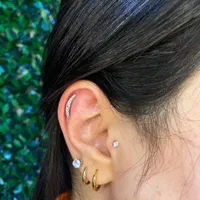 خدمات میکرو درمال پانج پرسینگ با آنژوکت ودستگاه