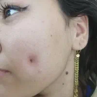 خدمات ژل وبوتاکس. تتو وانزیم وپرسینگ|خدمات آرایشگری و زیبایی|مشهد, شهرک شهید باهنر|دیوار