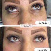 تزریق ژل بوتاکس لیفت نخ هایفو بلفاروپلاستی لیزر|خدمات آرایشگری و زیبایی|مشهد, کوه سنگی|دیوار