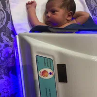 اجاره دستگاهblue light+زردی نوزاد(۲۴h(تمام مناطق|پزشکی|تهران, پرستار|دیوار