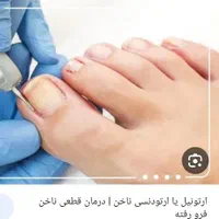 ارتونیل ناخن(ناخن فرورفته در گوشت) درمان عفونت|خدمات آرایشگری و زیبایی|اصفهان, طامه|دیوار