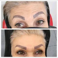 جشنواره نوروزمدل ژل وبوتاکس هایفو تراپی مزوتراپی ‌|خدمات آرایشگری و زیبایی|تهران, تهرانپارس شرقی|دیوار
