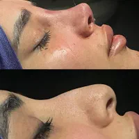 عمل جراحی بینی..صورت..بدن اهواز