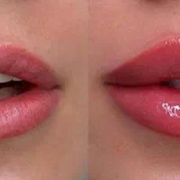 زیبایی کل صورت با سی سی 400|خدمات آرایشگری و زیبایی|اصفهان, شهشهان|دیوار