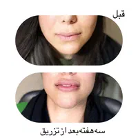 خدمات زیبایی مهرسیما|خدمات آرایشگری و زیبایی|اصفهان, جلفا|دیوار