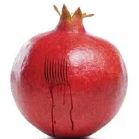 «انواع حجامت و زالو درمانی آقا و خانم»