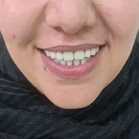 لابراتوار تخصصی دندانسازی.دندان مصنوعی|خدمات آرایشگری و زیبایی|اصفهان, جاوان|دیوار