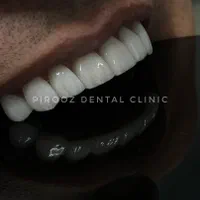 انجام کلیه خدمات دندانپزشکی به صورت نقد و اقساطی|خدمات آرایشگری و زیبایی|تهران, نیروی هوایی (پیروزی)|دیوار