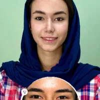 عمل جراحی بینی ۲۴میلیون/بهترین متخصص کرج|خدمات آرایشگری و زیبایی|کرج, فاز ۱ مهرشهر|دیوار