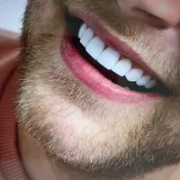 کامپوزیت دندان /لمینت / عصب کشی / زیبایی|خدمات آرایشگری و زیبایی|تهران, تهرانپارس غربی|دیوار