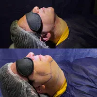 کلنیک تخصصی لیزرموی زائد و لاغری|خدمات آرایشگری و زیبایی|تهران, صادقیه|دیوار