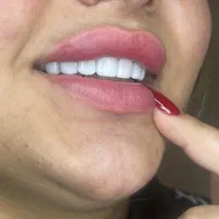 تخفیف ویژه خدمات کامپوزیت