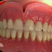دندانسازی سینا ساخت دندان مصنوعی سازی متحرک و نرم|خدمات آرایشگری و زیبایی|شیراز, سینما سعدی|دیوار