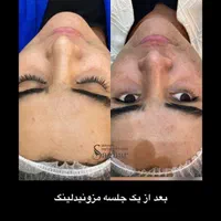 ۵۰ درصد تخفیف ویژه فیشال به مدت ۳ روز|خدمات آرایشگری و زیبایی|اهواز, کیانپارس |دیوار