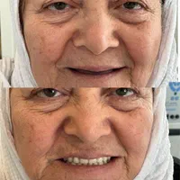 دندانسازی رویال (مرادلو)|خدمات آرایشگری و زیبایی|تهران, قنات‌کوثر|دیوار