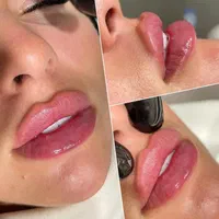 تزریق بوتاکس / ژل / لیزر / مزوتراپی توسط پزشک
