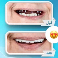 کلینیک تخصصی دندانپزشکی و ایمپلنت  در سیرجان|خدمات آرایشگری و زیبایی|سیرجان, |دیوار