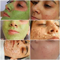 مدل فیشال و پاکسازی پوست|خدمات آرایشگری و زیبایی|تهران, سبلان (لشگر)|دیوار
