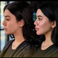 آموزش تخصصی فیلر و بوتاکس خدمات زیبایی|خدمات آموزشی|مشهد, هنرستان|دیوار