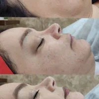 آموزش پاکسازی صورت و دست|خدمات آموزشی|تهران, کن|دیوار
