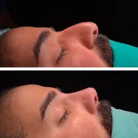 لیپو ابدو پروتز مامو لیفت شقیقه جراحی بینی بلفارو|خدمات آرایشگری و زیبایی|تهران, یوسف‌آباد|دیوار